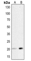 HSP20 (Phospho-S16) Antibody