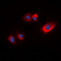HSP20 (Phospho-S16) Antibody