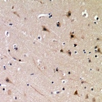 DDX3X (Phospho-T322) Antibody