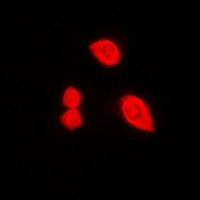 DDX3X (Phospho-T322) Antibody