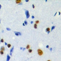 MKI67IP (Phospho-T234) Antibody