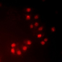 MKI67IP (Phospho-T234) Antibody