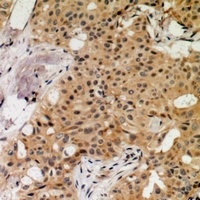 MNK1 (Phospho-T250) Antibody