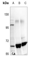 TIP60 Rabbit Polyclonal Antibody