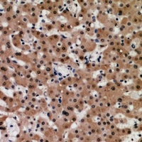 TIP60 Rabbit Polyclonal Antibody