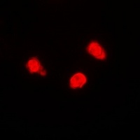 TIP60 Rabbit Polyclonal Antibody