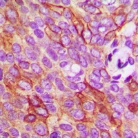TMEM16J Rabbit Polyclonal Antibody