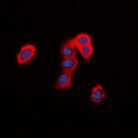 TMEM16J Rabbit Polyclonal Antibody
