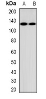 MUC1 Rabbit Polyclonal Antibody