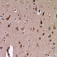 MUC1 Rabbit Polyclonal Antibody