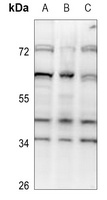 SRSF5 Rabbit Polyclonal Antibody