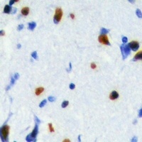 SRSF5 Rabbit Polyclonal Antibody