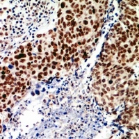TEAD2 Antibody