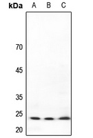 TP53INP2 Rabbit Polyclonal Antibody