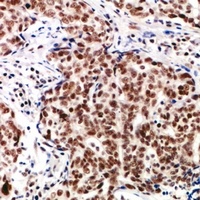 TP53INP2 Rabbit Polyclonal Antibody
