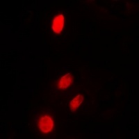 TP53INP2 Rabbit Polyclonal Antibody