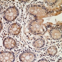STEAP2 Rabbit Polyclonal Antibody