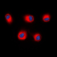 STEAP2 Rabbit Polyclonal Antibody