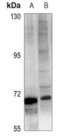 ICK Rabbit Polyclonal Antibody