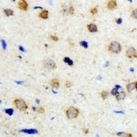 ICK Rabbit Polyclonal Antibody