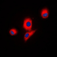 ICK Rabbit Polyclonal Antibody