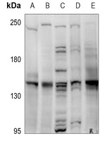 MYBPC3 Rabbit Polyclonal Antibody