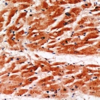 MYBPC3 Rabbit Polyclonal Antibody