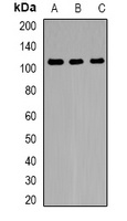 FNBP3 Rabbit Polyclonal Antibody