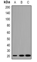 TRAPPC5 Rabbit Polyclonal Antibody