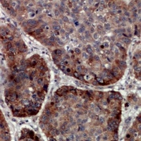 TRAPPC5 Rabbit Polyclonal Antibody