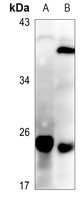 SFT2D3 Rabbit Polyclonal Antibody