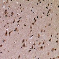 SFT2D3 Rabbit Polyclonal Antibody