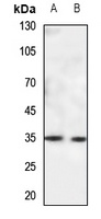 CACNG5 Rabbit Polyclonal Antibody