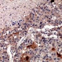 ZNT2 Antibody
