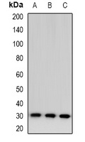 TSSK6 Rabbit Polyclonal Antibody
