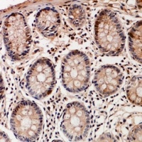 TSSK6 Rabbit Polyclonal Antibody