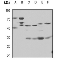 CD85c Rabbit Polyclonal Antibody