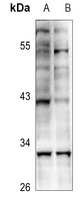 KLF13 (Acetyl-K166) Antibody