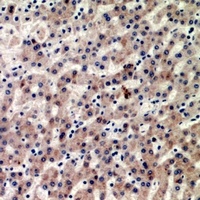 CIDEB Rabbit Polyclonal Antibody