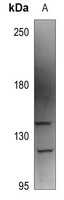 AAK1 Rabbit Polyclonal Antibody