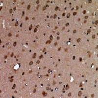 AAK1 Rabbit Polyclonal Antibody