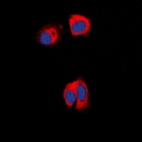 AAK1 Rabbit Polyclonal Antibody
