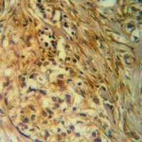 ITPK1 Rabbit Polyclonal Antibody
