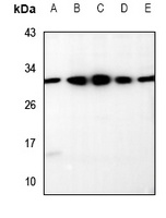 RRP7A/B Rabbit Polyclonal Antibody