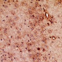 RRP7A/B Rabbit Polyclonal Antibody