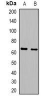 IL-16 Rabbit Polyclonal Antibody