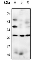 Claudin 17 Rabbit Polyclonal Antibody
