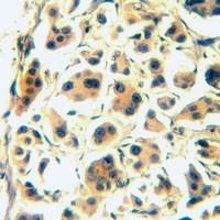 CD126 Antibody