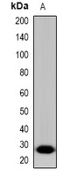 LAT Rabbit Polyclonal Antibody