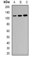 CD21 Antibody